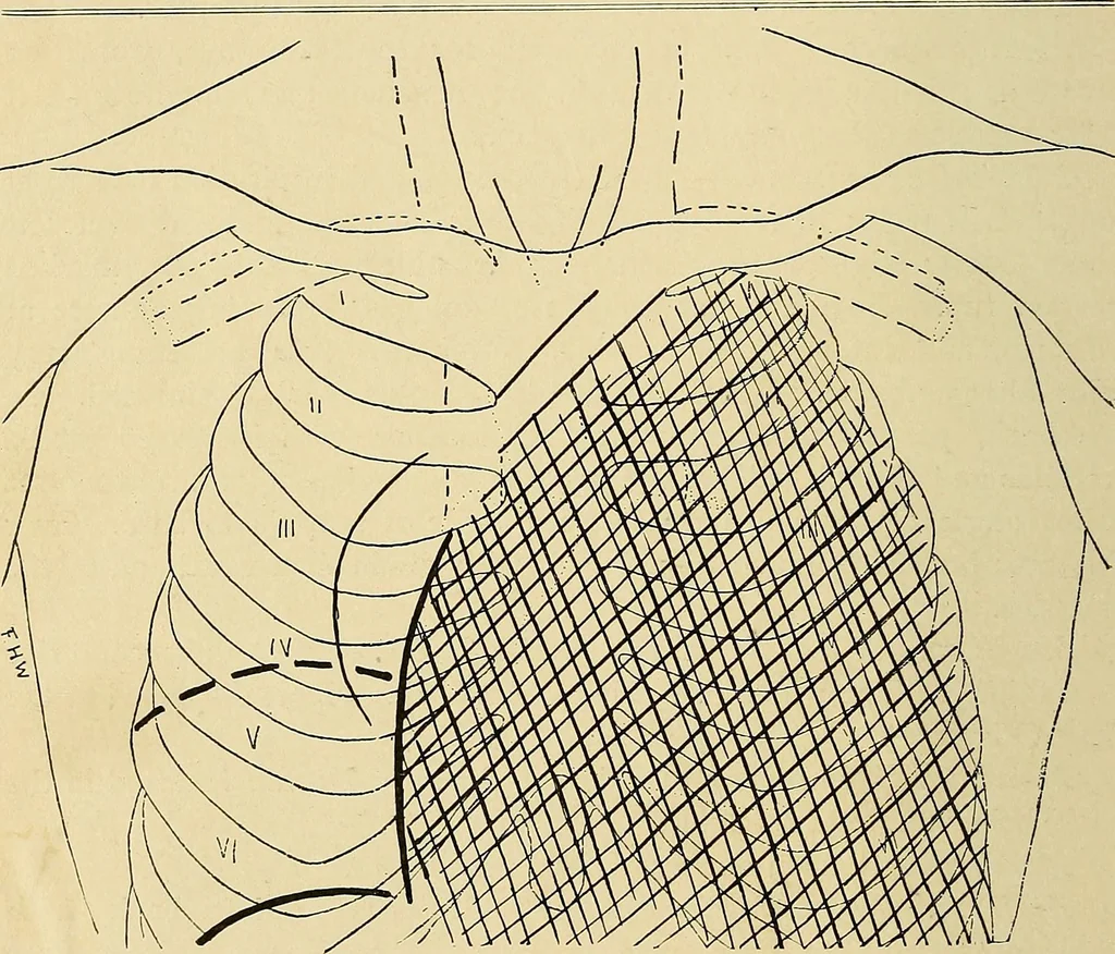An illustration from The Roentgen rays in medicine and surgery as an aid in diagnosis and as a therapeutic agent : designed for the use of practitioners and students, 1901, leaf 233