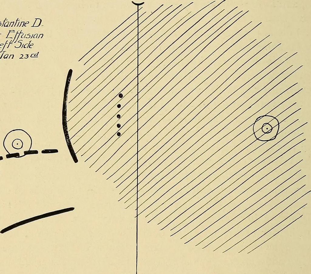 An illustration from The Roentgen rays in medicine and surgery as an aid in diagnosis and as a therapeutic agent : designed for the use of practitioners and students, 1901, leaf 237