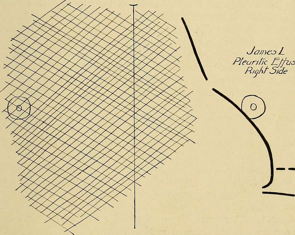 An illustration from The Roentgen rays in medicine and surgery as an aid in diagnosis and as a therapeutic agent : designed for the use of practitioners and students, 1901, leaf 238