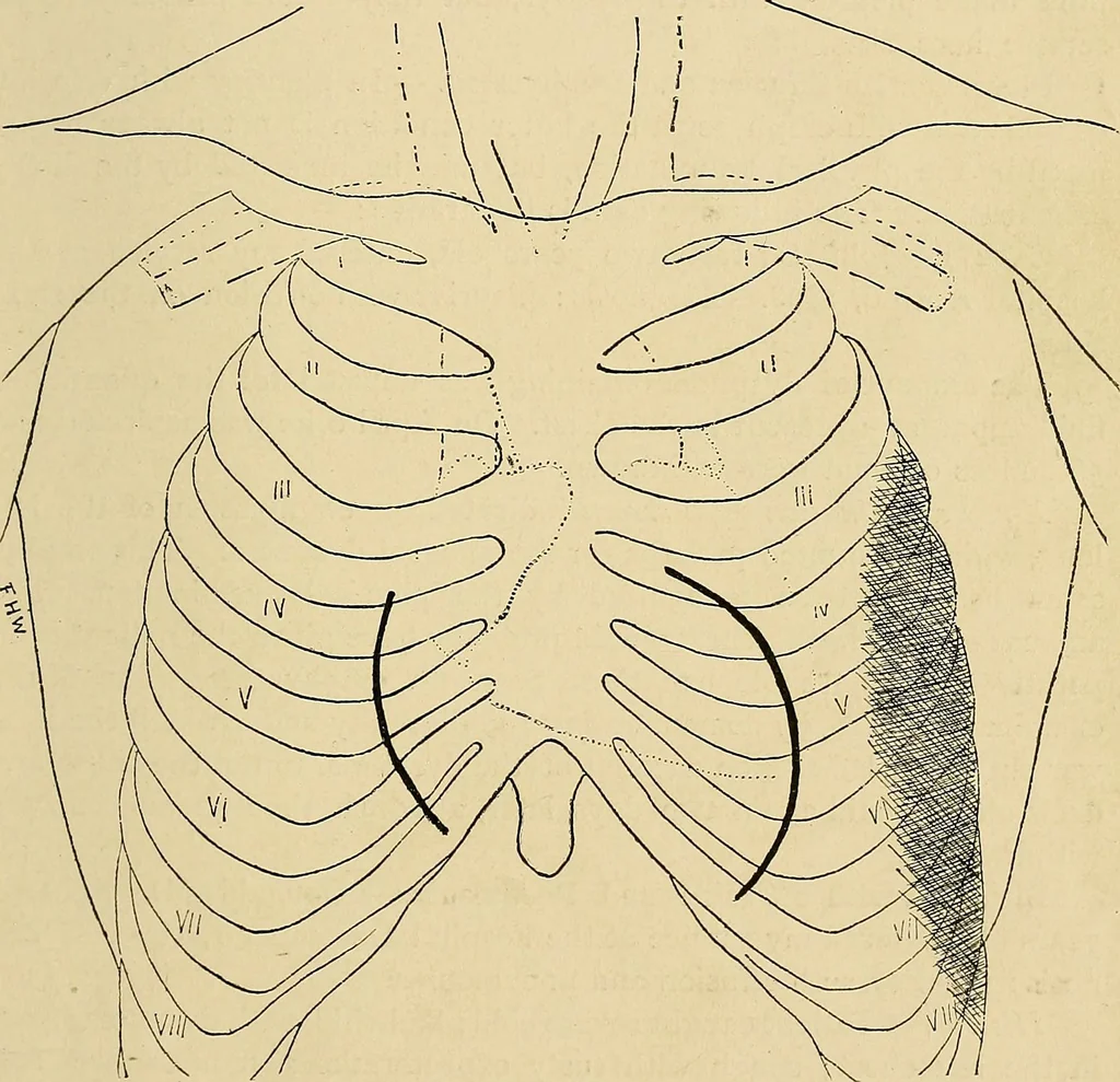 An illustration from The Roentgen rays in medicine and surgery as an aid in diagnosis and as a therapeutic agent : designed for the use of practitioners and students, 1901, leaf 240