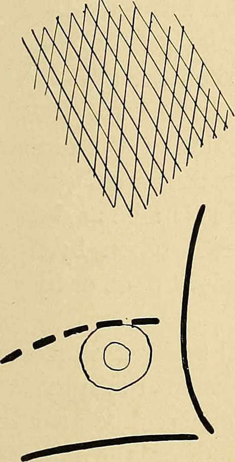 An illustration from The Roentgen rays in medicine and surgery as an aid in diagnosis and as a therapeutic agent : designed for the use of practitioners and students, 1901, leaf 242