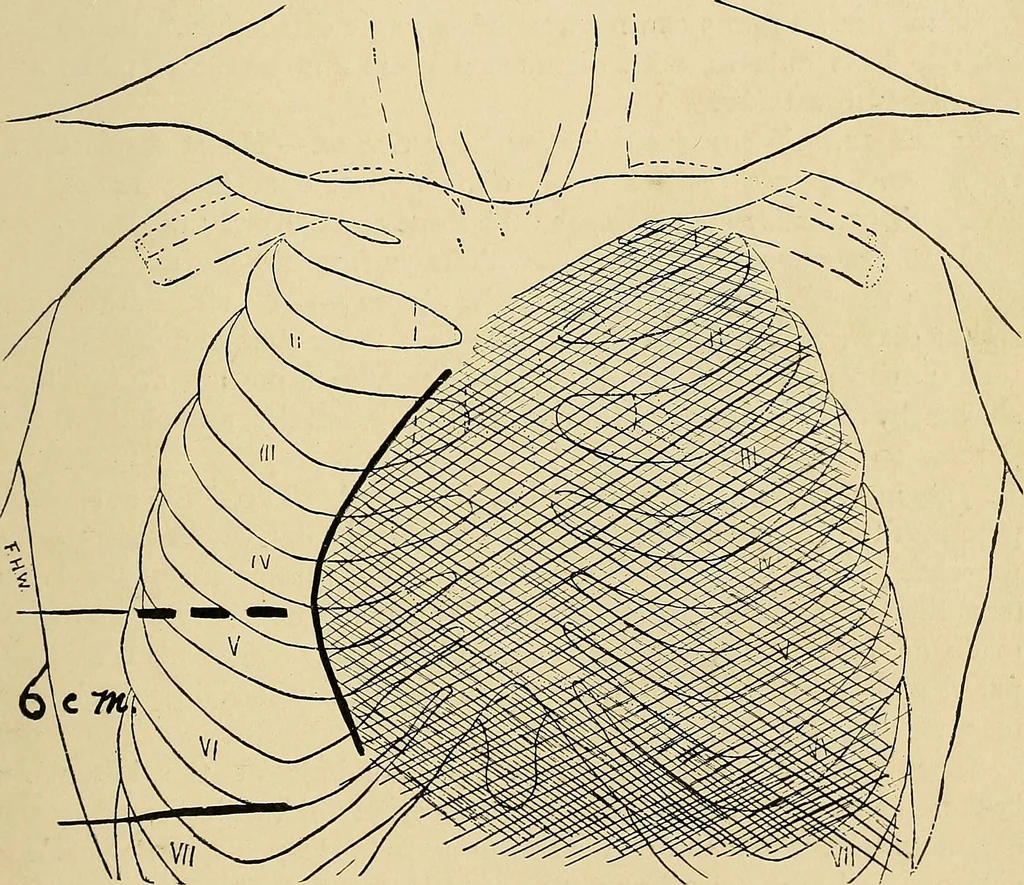 An illustration from The Roentgen rays in medicine and surgery as an aid in diagnosis and as a therapeutic agent : designed for the use of practitioners and students, 1901, leaf 250
