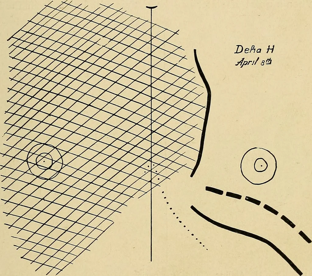 An illustration from The Roentgen rays in medicine and surgery as an aid in diagnosis and as a therapeutic agent : designed for the use of practitioners and students, 1901, leaf 256
