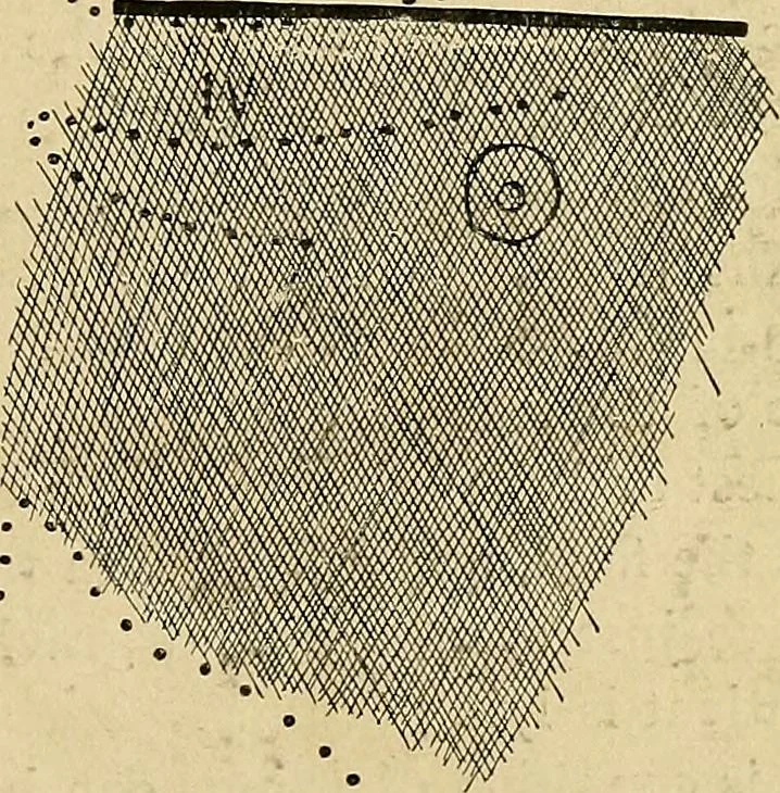 An illustration from The Roentgen rays in medicine and surgery as an aid in diagnosis and as a therapeutic agent : designed for the use of practitioners and students, 1901, leaf 262