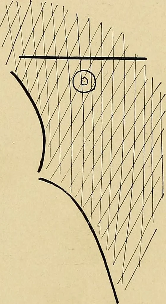 An illustration from The Roentgen rays in medicine and surgery as an aid in diagnosis and as a therapeutic agent : designed for the use of practitioners and students, 1901, leaf 264