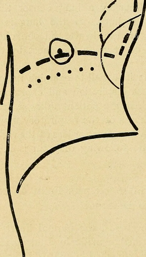 An illustration from The Roentgen rays in medicine and surgery as an aid in diagnosis and as a therapeutic agent : designed for the use of practitioners and students, 1901, leaf 273
