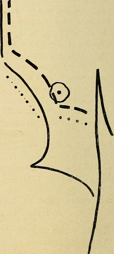 An illustration from The Roentgen rays in medicine and surgery as an aid in diagnosis and as a therapeutic agent : designed for the use of practitioners and students, 1901, leaf 273