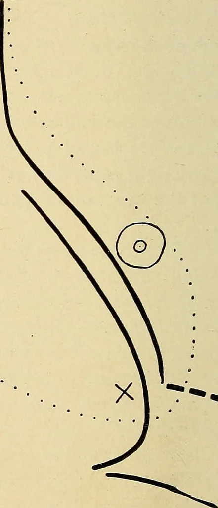 An illustration from The Roentgen rays in medicine and surgery as an aid in diagnosis and as a therapeutic agent : designed for the use of practitioners and students, 1901, leaf 285