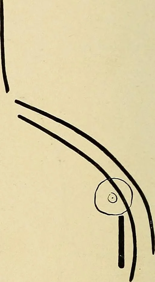 An illustration from The Roentgen rays in medicine and surgery as an aid in diagnosis and as a therapeutic agent : designed for the use of practitioners and students, 1901, leaf 287