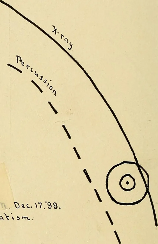 An illustration from The Roentgen rays in medicine and surgery as an aid in diagnosis and as a therapeutic agent : designed for the use of practitioners and students, 1901, leaf 301