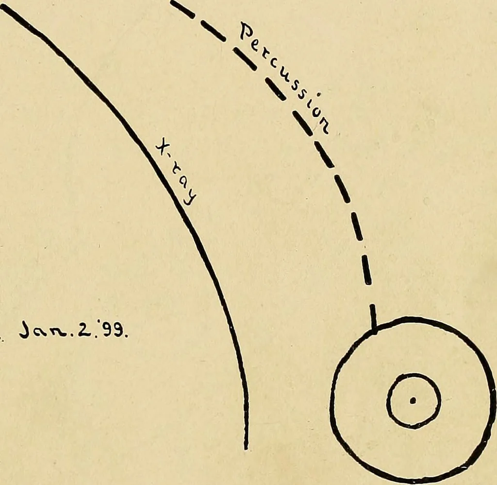 An illustration from The Roentgen rays in medicine and surgery as an aid in diagnosis and as a therapeutic agent : designed for the use of practitioners and students, 1901, leaf 302