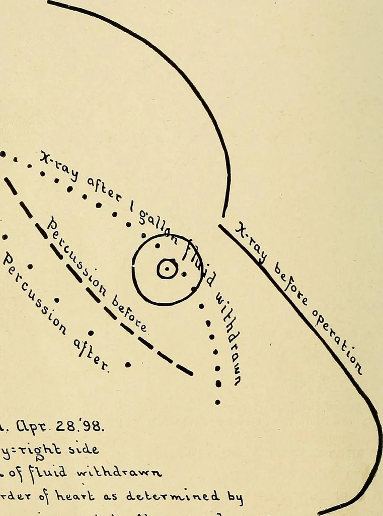 An illustration from The Roentgen rays in medicine and surgery as an aid in diagnosis and as a therapeutic agent : designed for the use of practitioners and students, 1901, leaf 303