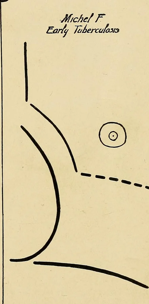 An illustration from The Roentgen rays in medicine and surgery as an aid in diagnosis and as a therapeutic agent : designed for the use of practitioners and students, 1901, leaf 308