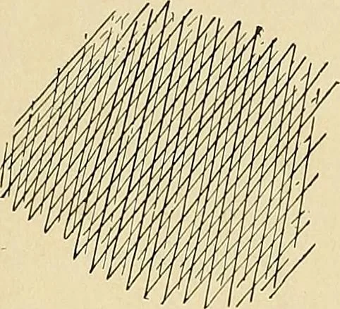 An illustration from The Roentgen rays in medicine and surgery as an aid in diagnosis and as a therapeutic agent : designed for the use of practitioners and students, 1901, leaf 309