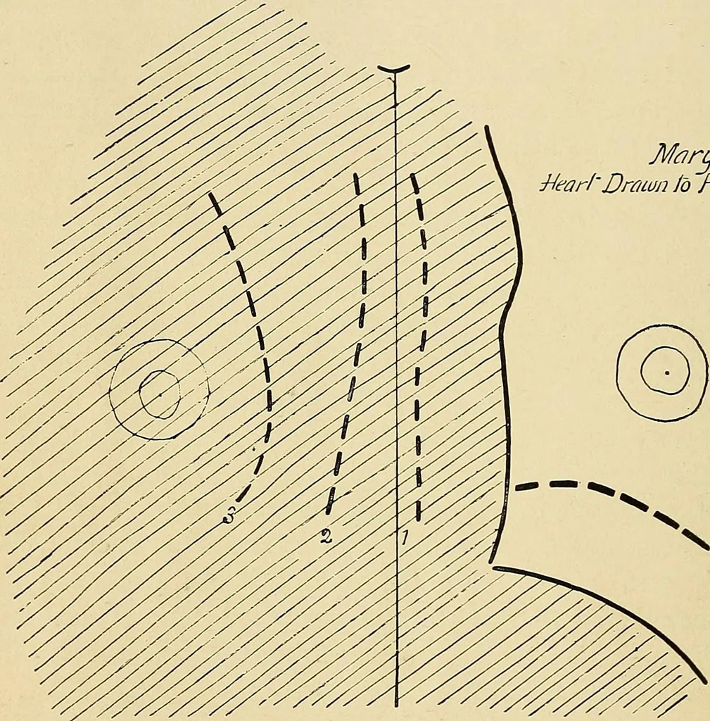 An illustration from The Roentgen rays in medicine and surgery as an aid in diagnosis and as a therapeutic agent : designed for the use of practitioners and students, 1901, leaf 311