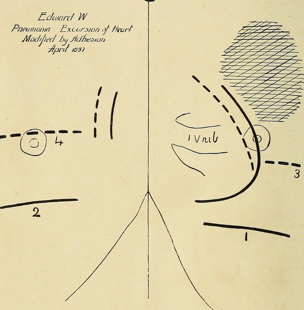 An illustration from The Roentgen rays in medicine and surgery as an aid in diagnosis and as a therapeutic agent : designed for the use of practitioners and students, 1901, leaf 313