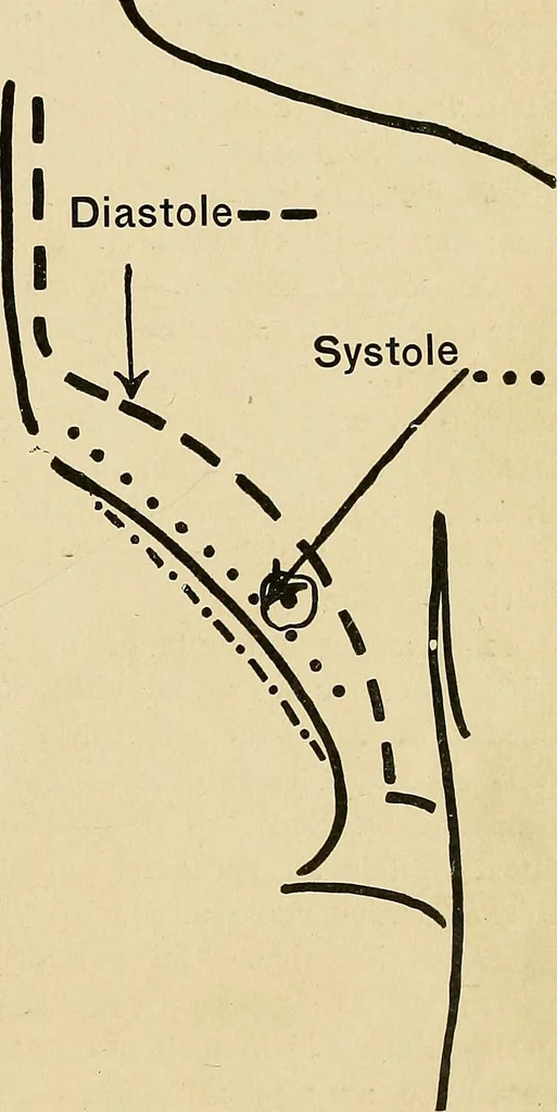 An illustration from The Roentgen rays in medicine and surgery as an aid in diagnosis and as a therapeutic agent : designed for the use of practitioners and students, 1901, leaf 318
