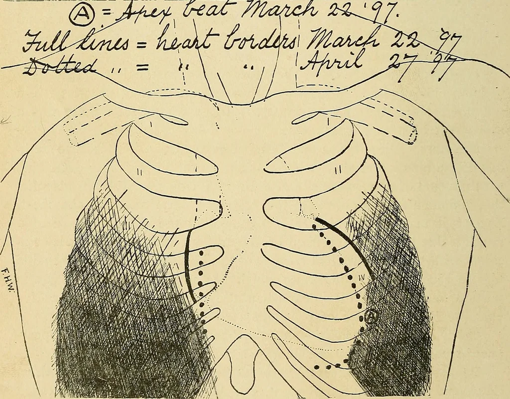 An illustration from The Roentgen rays in medicine and surgery as an aid in diagnosis and as a therapeutic agent : designed for the use of practitioners and students, 1901, leaf 321