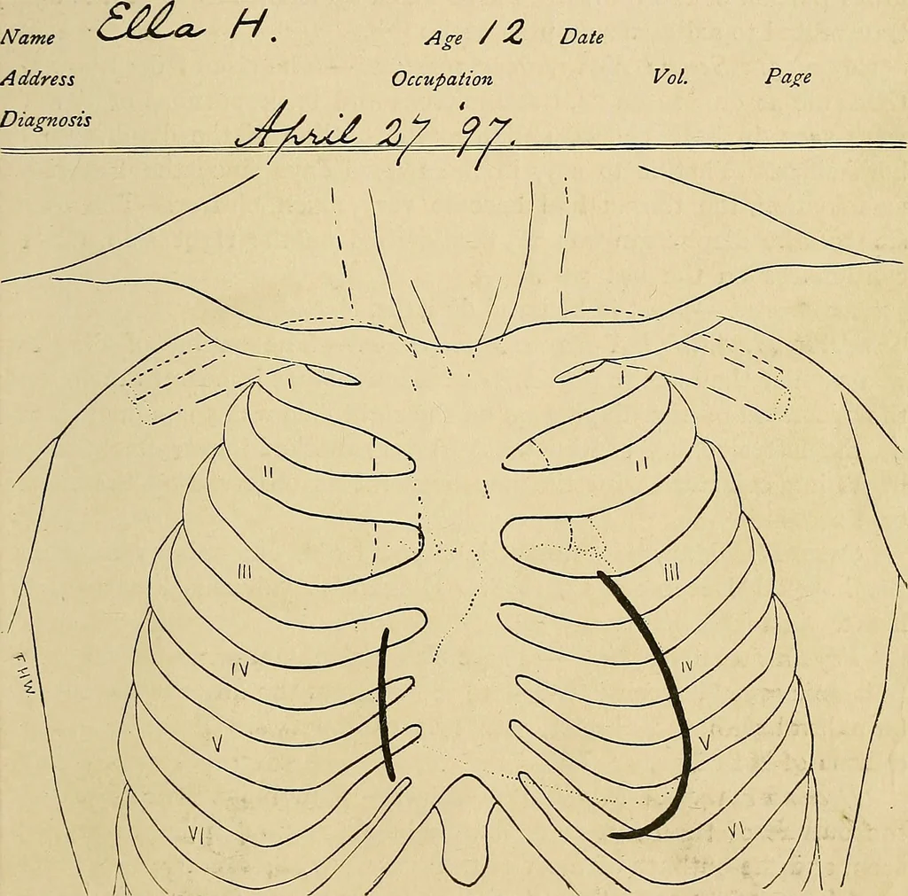 An illustration from The Roentgen rays in medicine and surgery as an aid in diagnosis and as a therapeutic agent : designed for the use of practitioners and students, 1901, leaf 322