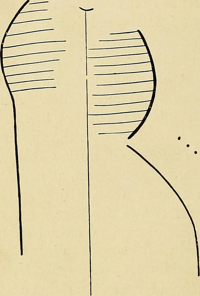 An illustration from The Roentgen rays in medicine and surgery as an aid in diagnosis and as a therapeutic agent : designed for the use of practitioners and students, 1901, leaf 335