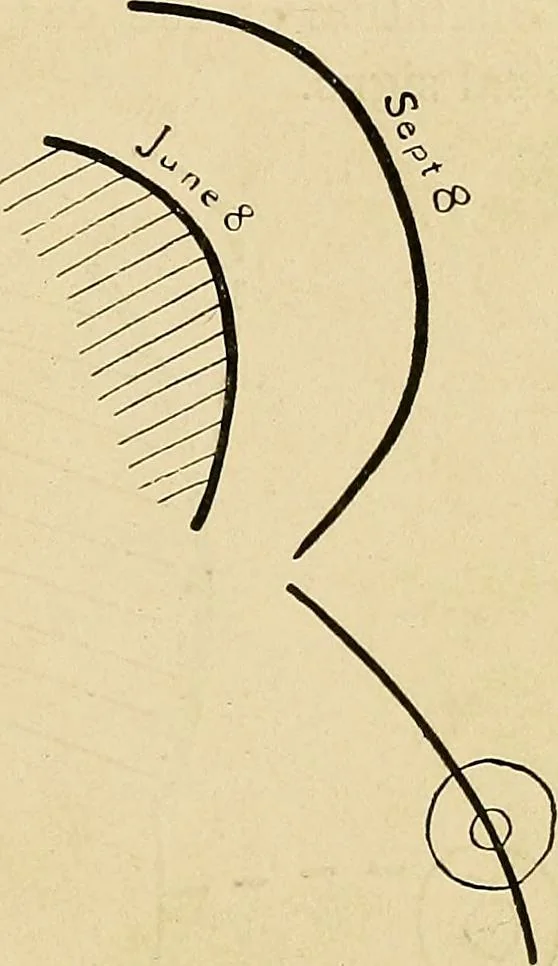 An illustration from The Roentgen rays in medicine and surgery as an aid in diagnosis and as a therapeutic agent : designed for the use of practitioners and students, 1901, leaf 338