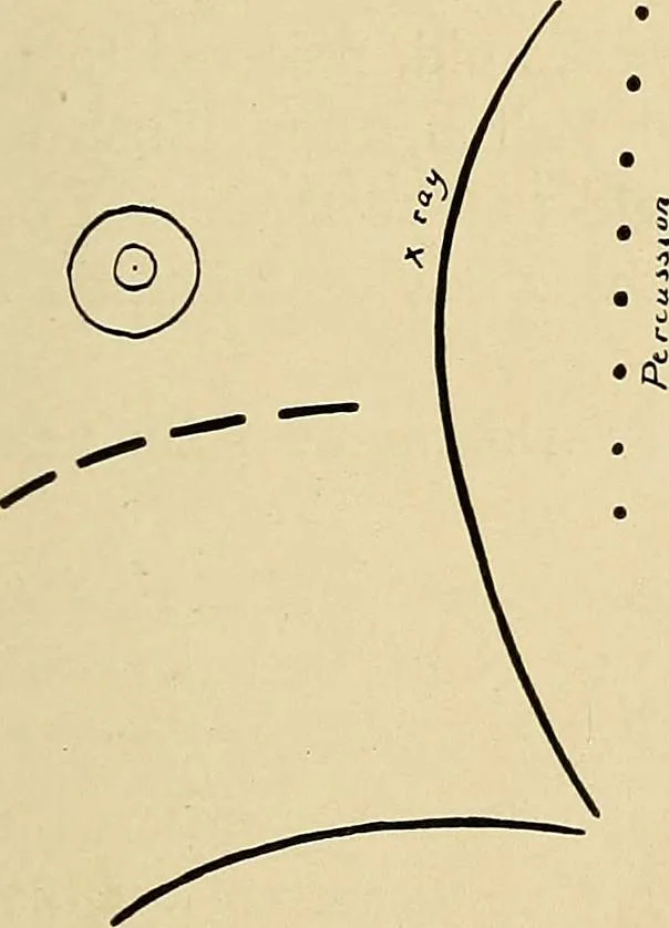 An illustration from The Roentgen rays in medicine and surgery as an aid in diagnosis and as a therapeutic agent : designed for the use of practitioners and students, 1901, leaf 340