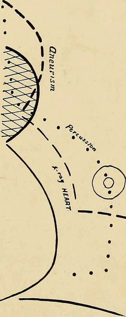 An illustration from The Roentgen rays in medicine and surgery as an aid in diagnosis and as a therapeutic agent : designed for the use of practitioners and students, 1901, leaf 340