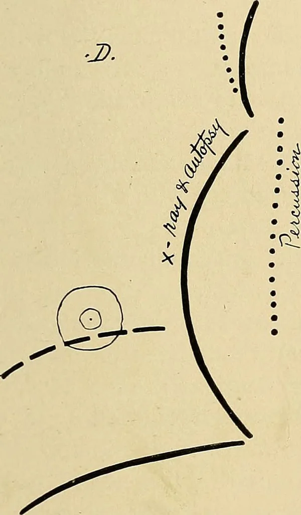 An illustration from The Roentgen rays in medicine and surgery as an aid in diagnosis and as a therapeutic agent : designed for the use of practitioners and students, 1901, leaf 346