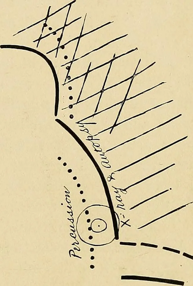 An illustration from The Roentgen rays in medicine and surgery as an aid in diagnosis and as a therapeutic agent : designed for the use of practitioners and students, 1901, leaf 346