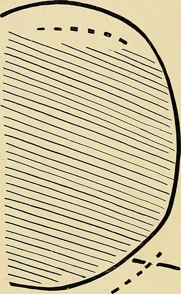 An illustration from The Roentgen rays in medicine and surgery as an aid in diagnosis and as a therapeutic agent : designed for the use of practitioners and students, 1901, leaf 353