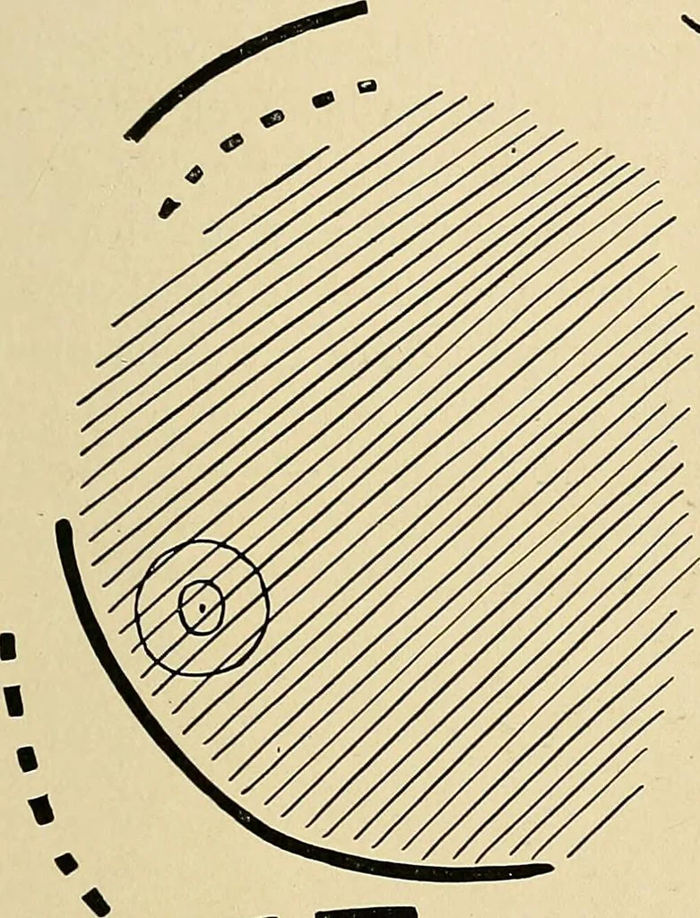 An illustration from The Roentgen rays in medicine and surgery as an aid in diagnosis and as a therapeutic agent : designed for the use of practitioners and students, 1901, leaf 354