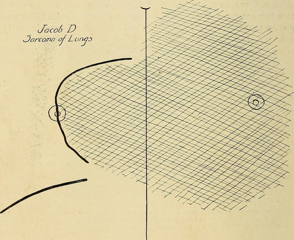 An illustration from The Roentgen rays in medicine and surgery as an aid in diagnosis and as a therapeutic agent : designed for the use of practitioners and students, 1901, leaf 357