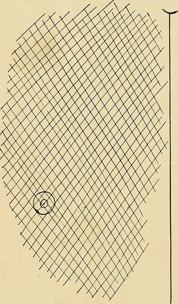 An illustration from The Roentgen rays in medicine and surgery as an aid in diagnosis and as a therapeutic agent : designed for the use of practitioners and students, 1901, leaf 361