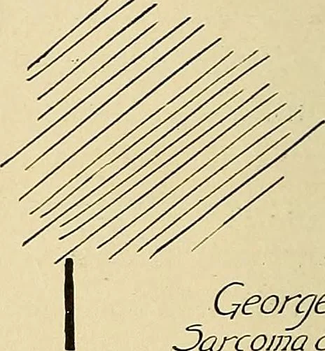 An illustration from The Roentgen rays in medicine and surgery as an aid in diagnosis and as a therapeutic agent : designed for the use of practitioners and students, 1901, leaf 361