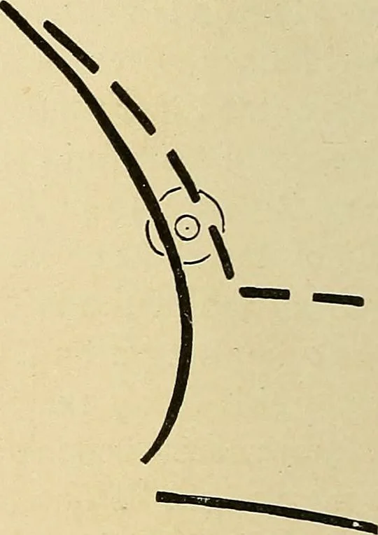 An illustration from The Roentgen rays in medicine and surgery as an aid in diagnosis and as a therapeutic agent : designed for the use of practitioners and students, 1901, leaf 361