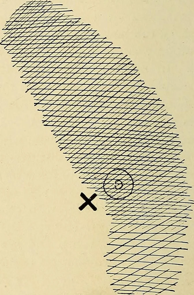 An illustration from The Roentgen rays in medicine and surgery as an aid in diagnosis and as a therapeutic agent : designed for the use of practitioners and students, 1901, leaf 363