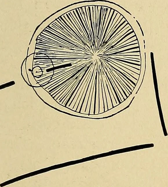 An illustration from The Roentgen rays in medicine and surgery as an aid in diagnosis and as a therapeutic agent : designed for the use of practitioners and students, 1901, leaf 364