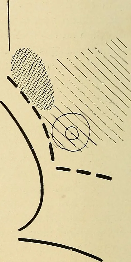 An illustration from The Roentgen rays in medicine and surgery as an aid in diagnosis and as a therapeutic agent : designed for the use of practitioners and students, 1901, leaf 369