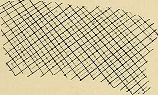 An illustration from The Roentgen rays in medicine and surgery as an aid in diagnosis and as a therapeutic agent : designed for the use of practitioners and students, 1901, leaf 370