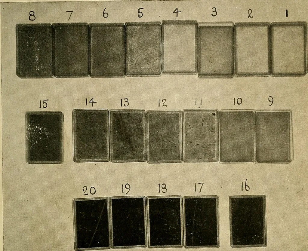An illustration from The Roentgen rays in medicine and surgery as an aid in diagnosis and as a therapeutic agent : designed for the use of practitioners and students, 1901, leaf 38