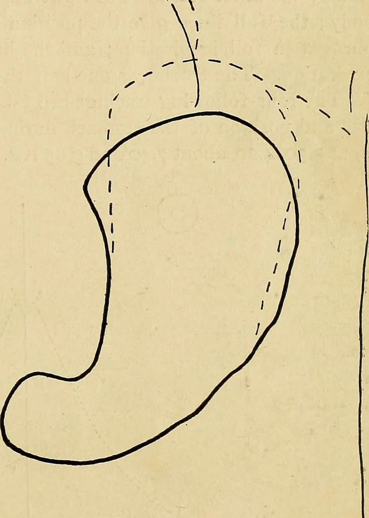 An illustration from The Roentgen rays in medicine and surgery as an aid in diagnosis and as a therapeutic agent : designed for the use of practitioners and students, 1901, leaf 380