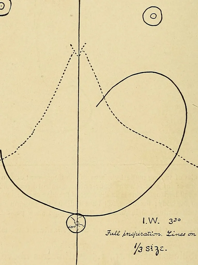 An illustration from The Roentgen rays in medicine and surgery as an aid in diagnosis and as a therapeutic agent : designed for the use of practitioners and students, 1901, leaf 381