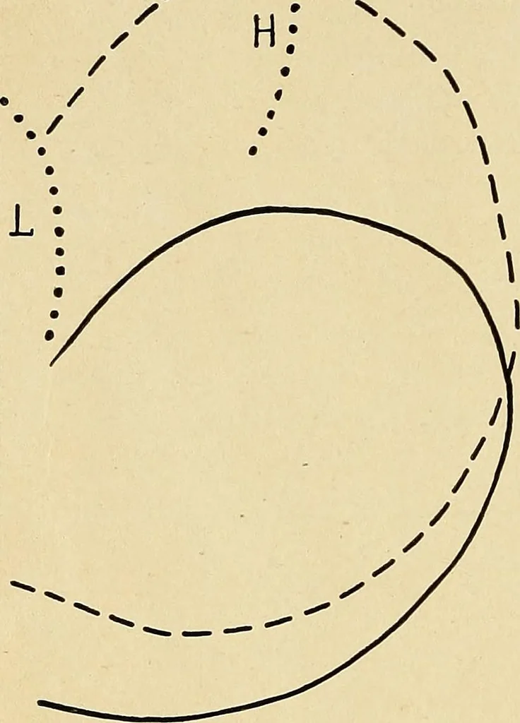 An illustration from The Roentgen rays in medicine and surgery as an aid in diagnosis and as a therapeutic agent : designed for the use of practitioners and students, 1901, leaf 383
