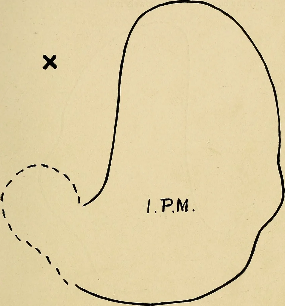 An illustration from The Roentgen rays in medicine and surgery as an aid in diagnosis and as a therapeutic agent : designed for the use of practitioners and students, 1901, leaf 384