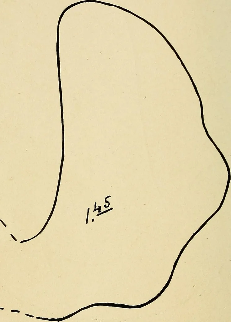 An illustration from The Roentgen rays in medicine and surgery as an aid in diagnosis and as a therapeutic agent : designed for the use of practitioners and students, 1901, leaf 385