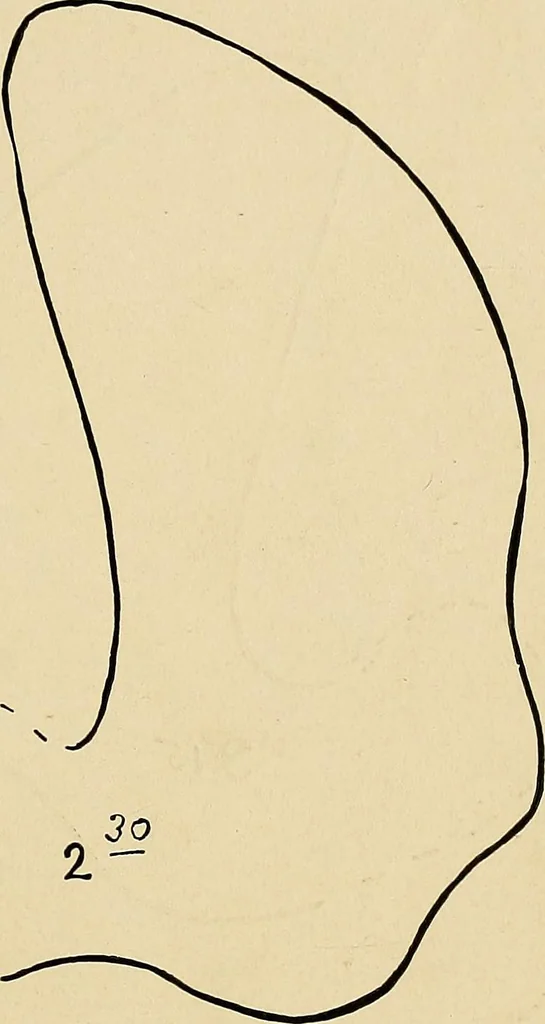 An illustration from The Roentgen rays in medicine and surgery as an aid in diagnosis and as a therapeutic agent : designed for the use of practitioners and students, 1901, leaf 386