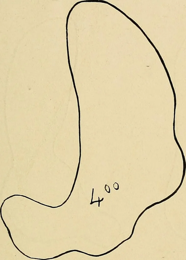 An illustration from The Roentgen rays in medicine and surgery as an aid in diagnosis and as a therapeutic agent : designed for the use of practitioners and students, 1901, leaf 388