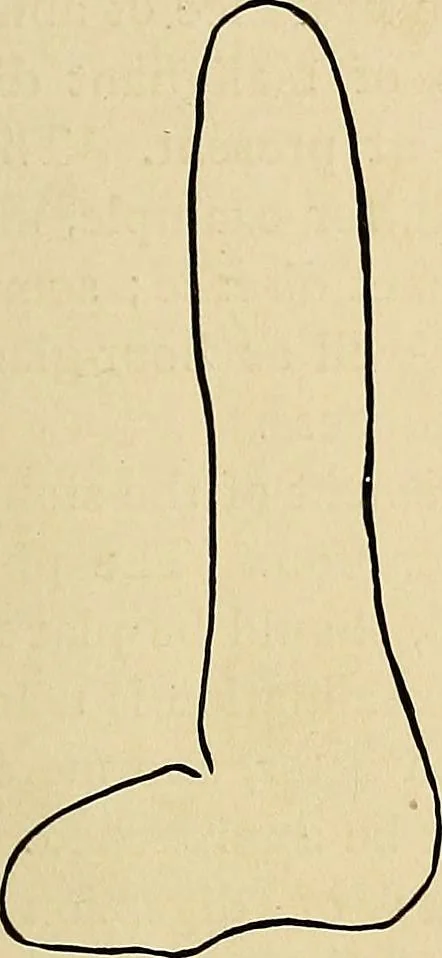 An illustration from The Roentgen rays in medicine and surgery as an aid in diagnosis and as a therapeutic agent : designed for the use of practitioners and students, 1901, leaf 390