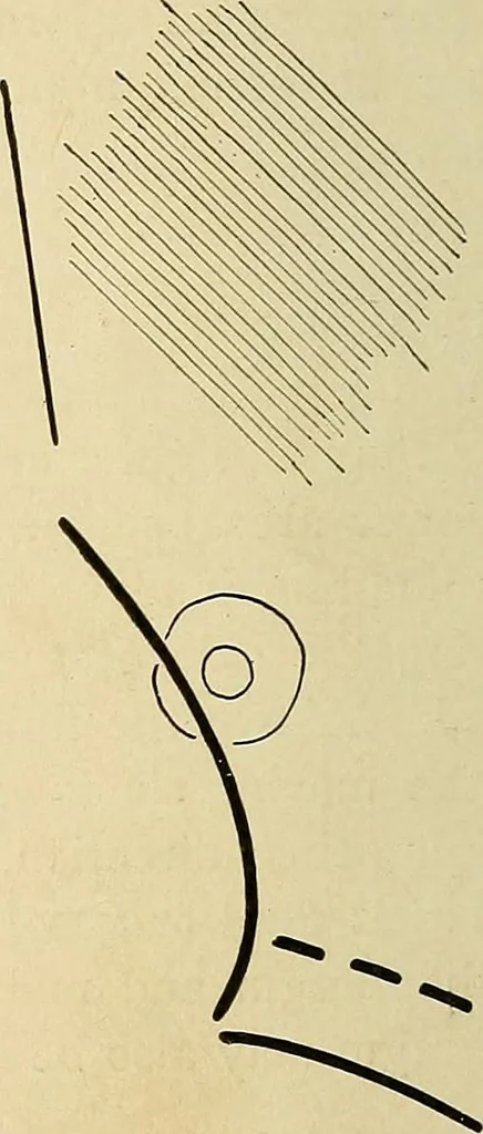 An illustration from The Roentgen rays in medicine and surgery as an aid in diagnosis and as a therapeutic agent : designed for the use of practitioners and students, 1901, leaf 395