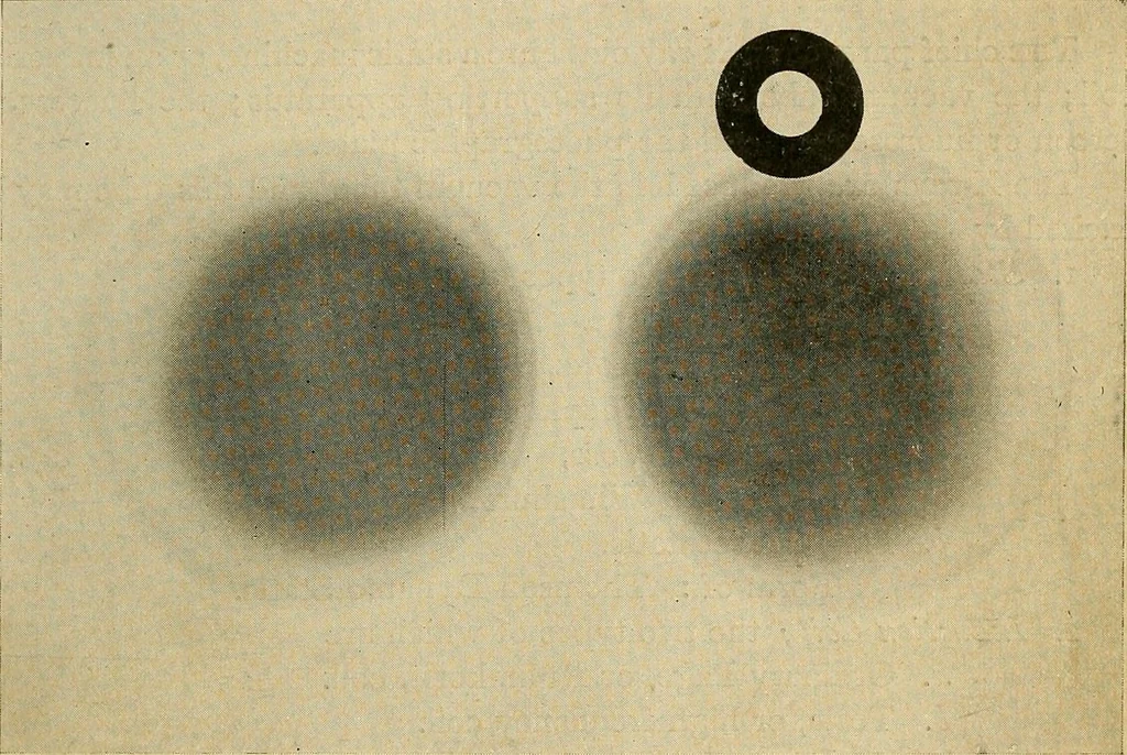 An illustration from The Roentgen rays in medicine and surgery as an aid in diagnosis and as a therapeutic agent : designed for the use of practitioners and students, 1901, leaf 40